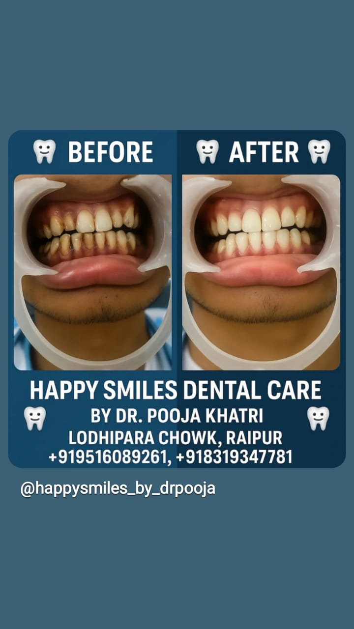Dental Treatment Result